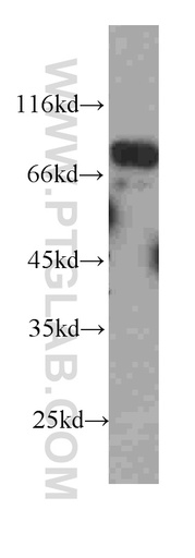 [60231-1-IG-150UL] FAF1 Monoclonal antibody