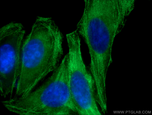 [60233-1-IG-150UL] MYH9 Monoclonal antibody