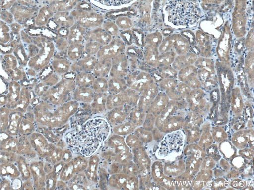 [60244-1-IG-150UL] PLAA Monoclonal antibody