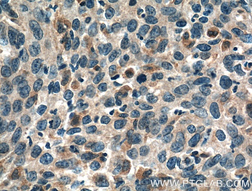 [60249-1-IG-20UL] PGRMC2 Monoclonal antibody