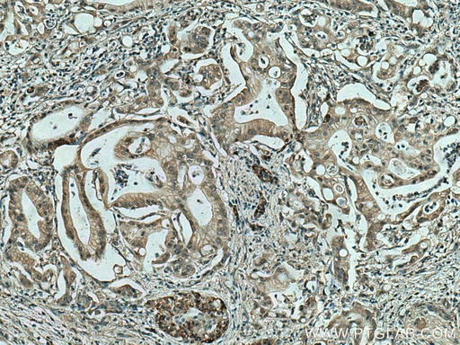 [60252-1-IG-20UL] MAPK13 Monoclonal antibody