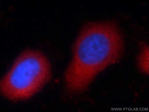 [60254-1-IG-150UL] Zyxin Monoclonal antibody