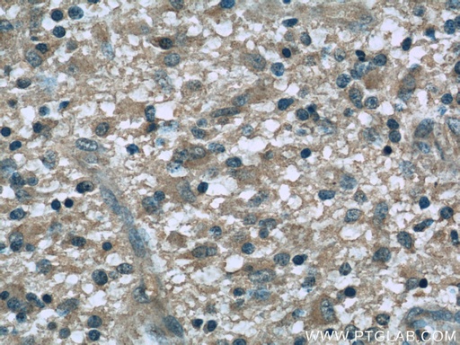 [60257-1-IG-150UL] Dynamitin (1-401 AA) Monoclonal antibody