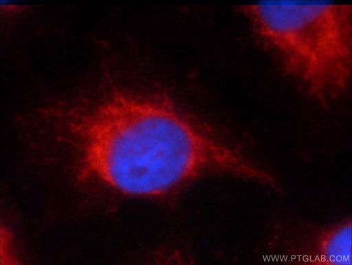 [60259-1-IG-150UL] Napsin A Monoclonal antibody