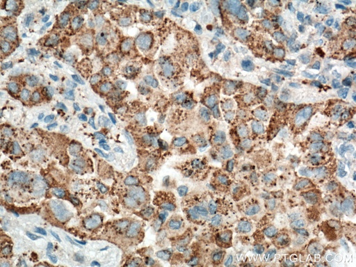 [60259-2-IG-150UL] Napsin A Monoclonal antibody