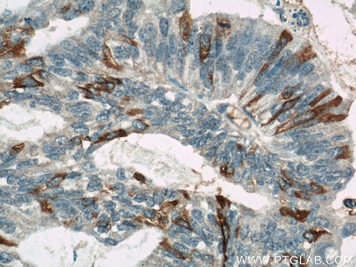 [60261-1-IG-20UL] MUC16,CA125 Monoclonal antibody