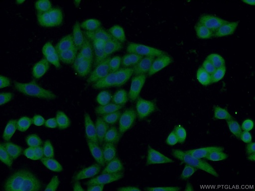 [60262-1-IG-150UL] IL-1R2 Monoclonal antibody