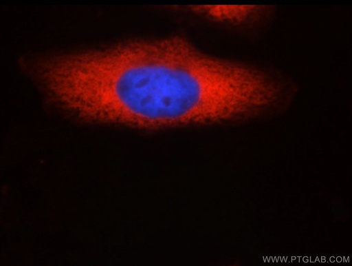[60265-1-IG-20UL] SND1 Monoclonal antibody