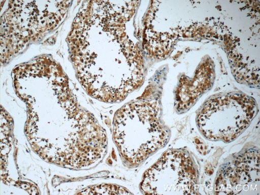 [60266-1-IG-150UL] KIFAP3 Monoclonal antibody