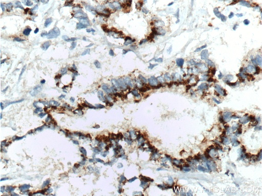 [60269-1-IG-150UL] IL-10 Monoclonal antibody