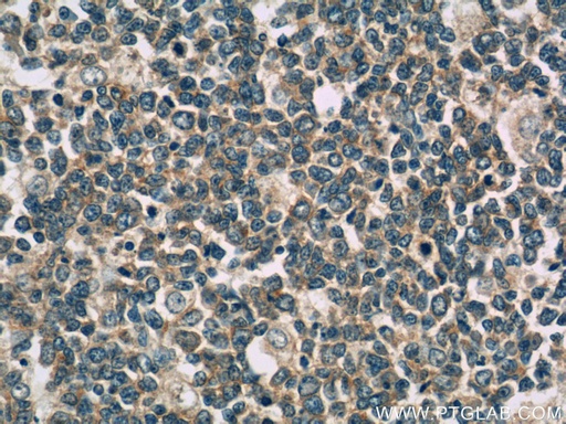 [60270-1-IG-20UL] IL-28A Monoclonal antibody