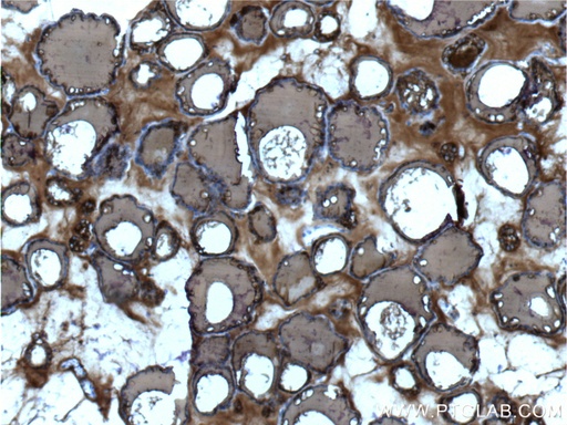 [60272-1-IG-20UL] Thyroglobulin Monoclonal antibody