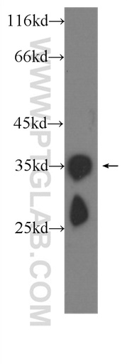 [60273-1-IG-20UL] CRYBB1 Monoclonal antibody