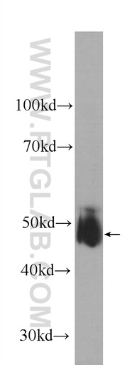 [60276-1-IG-150UL] KCNN4 Monoclonal antibody