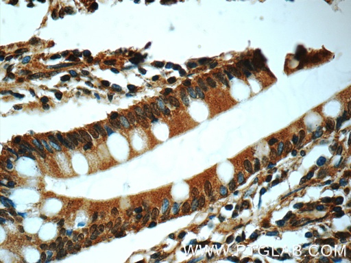 [60277-1-IG-20UL] Chk1 Monoclonal antibody