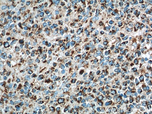 [60278-1-IG-150UL] IL-19 Monoclonal antibody