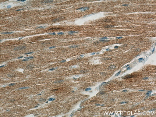 [60280-1-IG-150UL] FABP3 Monoclonal antibody