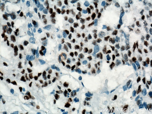 [60283-2-IG-20UL] P53 Monoclonal antibody