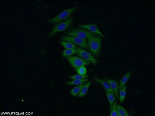 [60286-1-IG-20UL] PRDX4 Monoclonal antibody