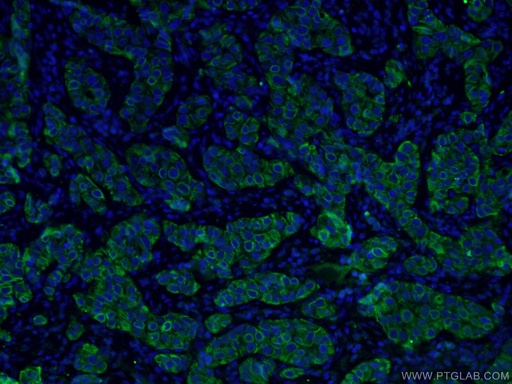 [60291-1-IG-150UL] TNF Alpha Monoclonal antibody