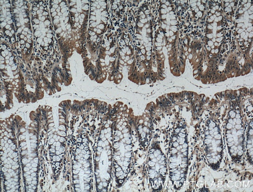 [60296-1-IG-20UL] IL-37 Monoclonal antibody