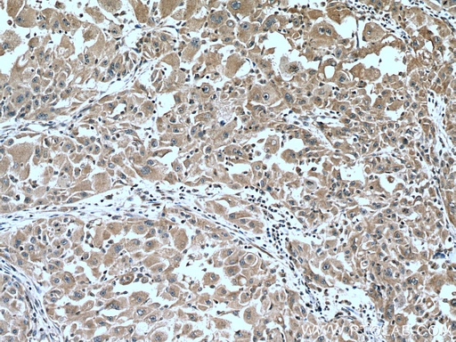 [60297-1-IG-150UL] CYP2D6 Monoclonal antibody