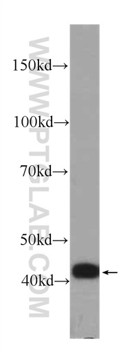[60298-1-IG-150UL] IL-36RN Monoclonal antibody
