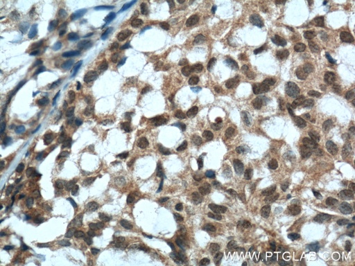 [60300-1-IG-20UL] PTEN Monoclonal antibody