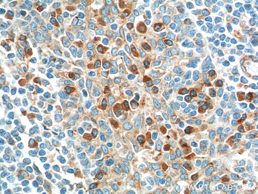 [60306-1-IG-150UL] IL-2 Monoclonal antibody