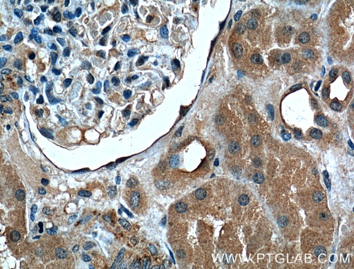 [60307-1-IG-20UL] FOLR1 Monoclonal antibody
