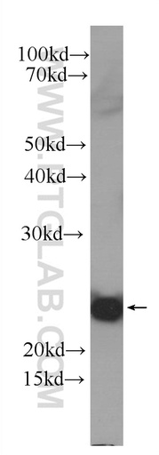 [60319-1-IG-150UL] IL-1F10 Monoclonal antibody