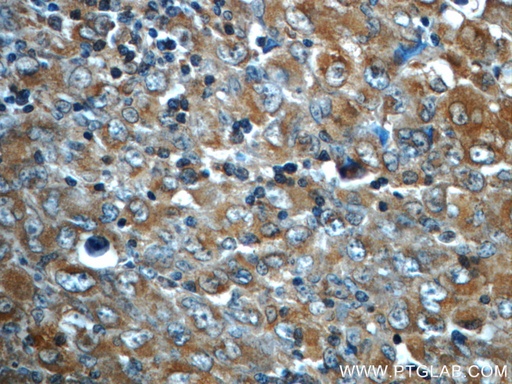 [60321-1-IG-20UL] ALK/CD246 Monoclonal antibody