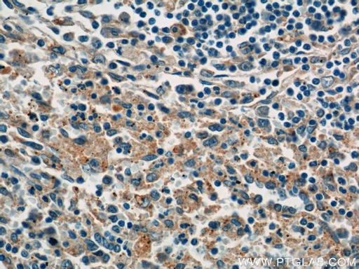 [60322-1-IG-150UL] P-selectin Monoclonal antibody