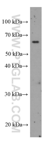 [60326-1-IG-150UL] Bestrophin-1 Monoclonal antibody
