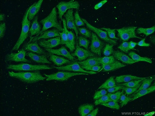 [60331-1-IG-150UL] NF-H Monoclonal antibody