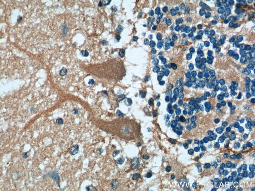 [60333-1-IG-150UL] TMEM106B Monoclonal antibody