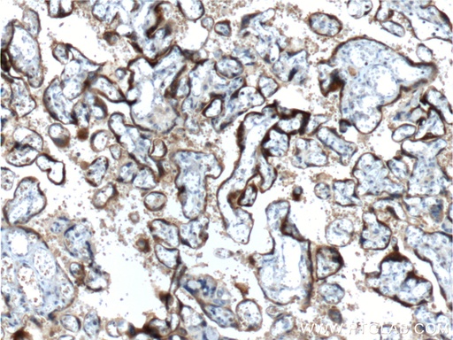 [60334-1-IG-150UL] hCG Beta Monoclonal antibody