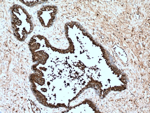 [60338-1-IG-150UL] KLK3/PSA Monoclonal antibody