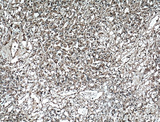 [60340-1-IG-150UL] ADRP/Perilipin 2 Monoclonal antibody