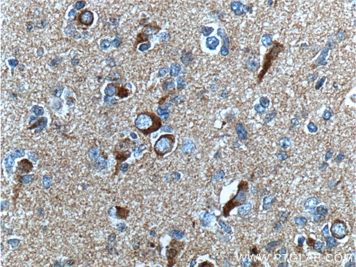 [60342-1-IG-20UL] Beta Amyloid Monoclonal antibody