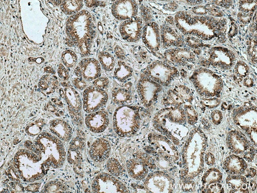 [60343-1-IG-150UL] Prostein Monoclonal antibody