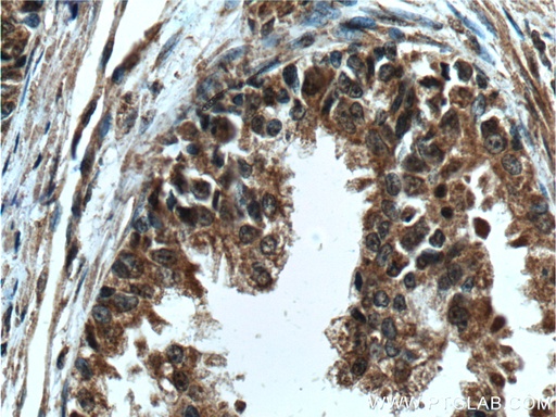 [60344-1-IG-150UL] LIN28 Monoclonal antibody