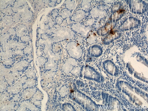 [60346-1-IG-150UL] Gastrin Monoclonal antibody