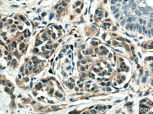 [60348-1-IG-150UL] Melan-A  Monoclonal antibody