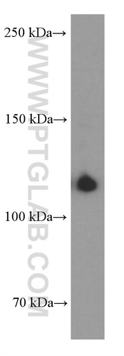 [60350-1-IG-20UL] CD41/Integrin Alpha 2B Monoclonal antibody