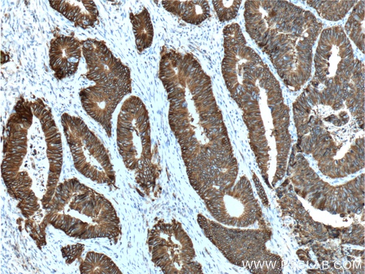 [60351-1-IG-150UL] Cadherin-17 Monoclonal antibody