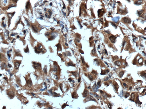 [60352-1-IG-150UL] Inhibin beta A-Specific Monoclonal antibody