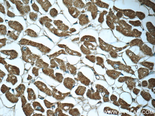 [60357-1-IG-150UL] Myocilin Monoclonal antibody