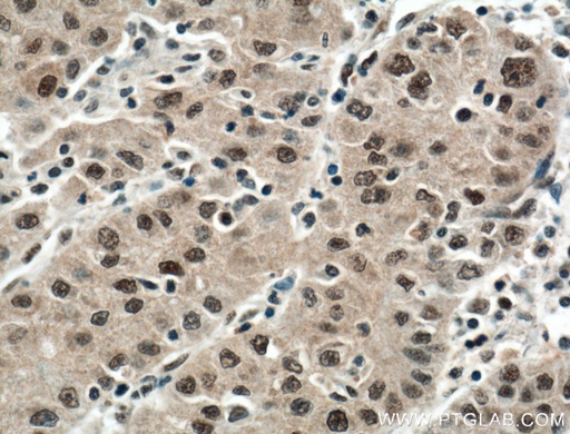 [66010-1-IG-150UL] DDB1 Monoclonal antibody