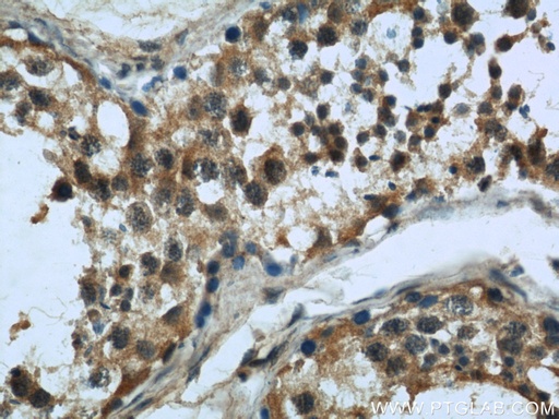 [66014-1-IG-20UL] MAD2L1 Monoclonal antibody